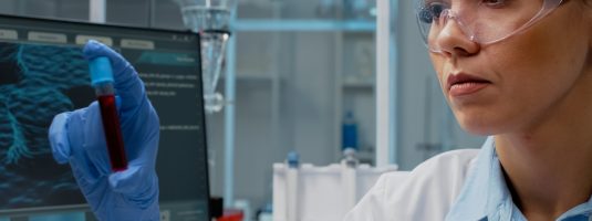 Close up of scientist analyzing lab vacutainer with fluid in laboratory. Woman with chemical equipment holding glass flask for blood cell examination. Transparent tube with solution